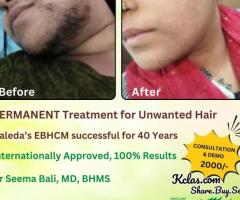 PERMANENT TREATMENT FOR UNWANTED HAIR VALEDA EBHCM