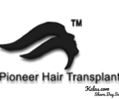 Best Hair Loss Treatment in Bangalore by Pioneer