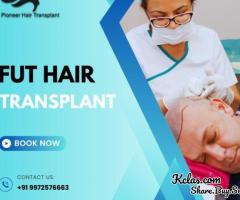 FUT Hair Transplant Cost in Bangalore-Pioneer Hair Transplant