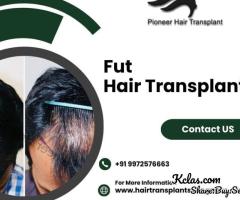 FUT Hair Transplant Cost in Bangalore-Pioneer Hair Transplant