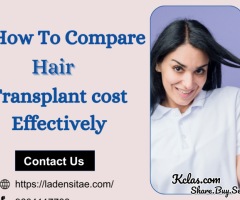 Understanding Hair Transplant Cost: Your Complete Guide by La Densitae